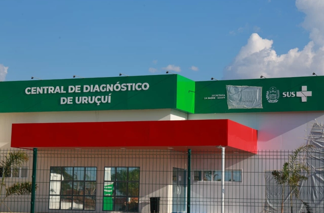 Uruçuí passa a contar Central de Diagnóstico
