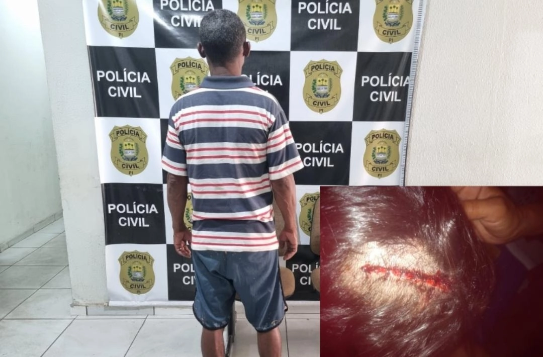 Homem é preso em Oeiras acusado de agredir companheira em Santa Cruz do Piauí