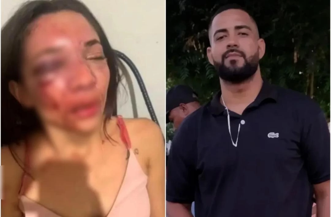 Jovem de Wall Ferraz é brutalmente agredida pelo companheiro em Picos