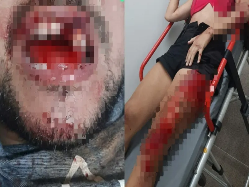 Adolescente não aceita fim de relacionamento e derruba ex-namorada e atual de motocicleta no Piauí