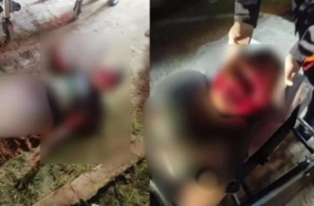 Homem é brutalmente agredido e fica com rosto desfigurado após tentativa de homicídio no Piauí