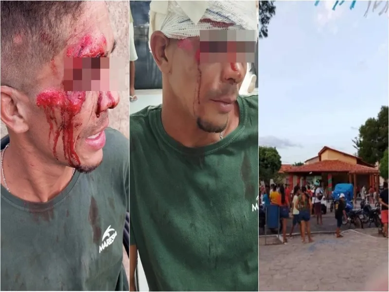Homem denuncia que foi agredido por comandante da Polícia Militar em bar no Piauí