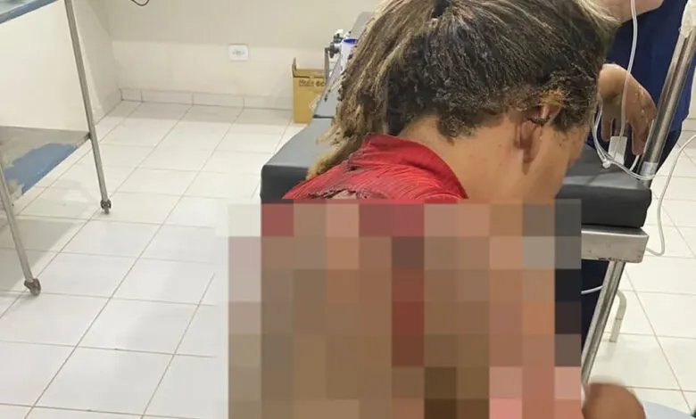 Homem é preso por colocar fogo na esposa enquanto ela dormia em Marcolândia