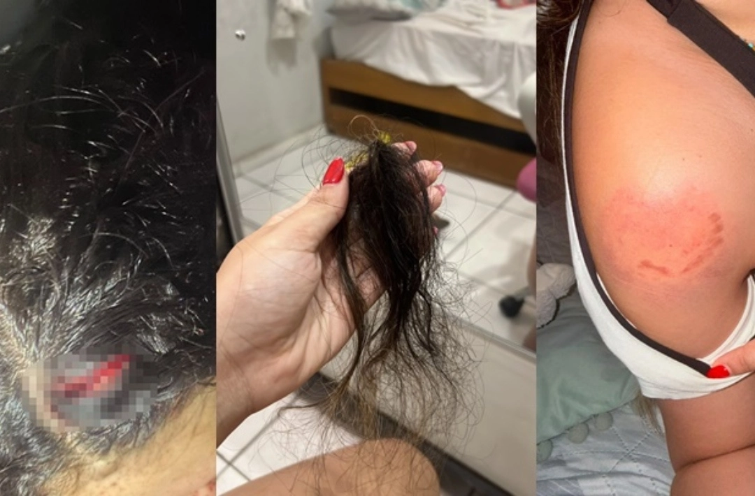 Professora denuncia agressão em terreiro no Mocambinho; suspeita seria ex de líder religioso