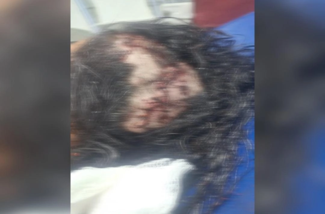 Preso suspeito de tentativa de feminicídio após agressão a pedradas em São João da Varjota