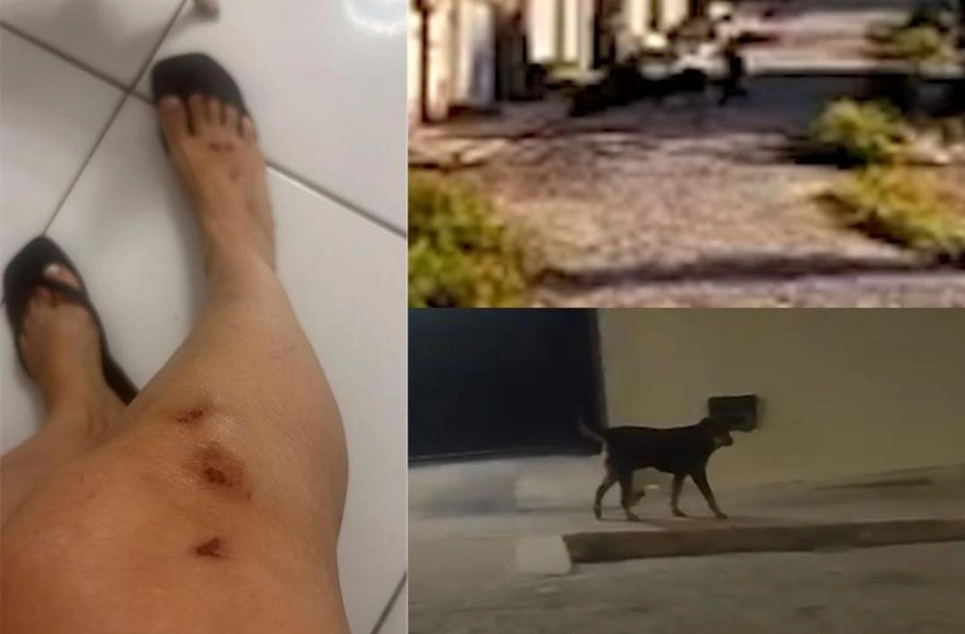 Mulher é atacada por rottweiler em Oeiras