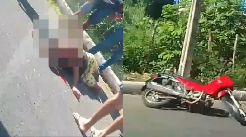 Motociclista sofre grave acidente ao passar por buraco em Teresina