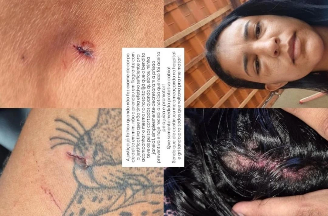 'Eu vivi um terror que nunca sairá da minha mente', diz secretária de Saúde ao denunciar tentativa de feminicídio em Francisco Ayres