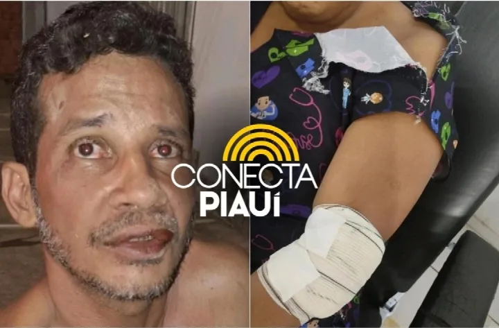 Mulher é esfaqueada pelo próprio companheiro em Demerval Lobão
