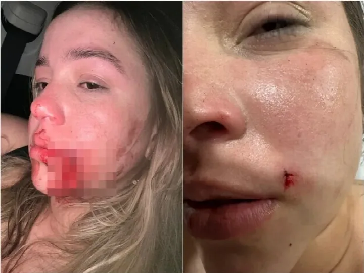 Estudante oeirense é agredida por síndico de prédio em Teresina