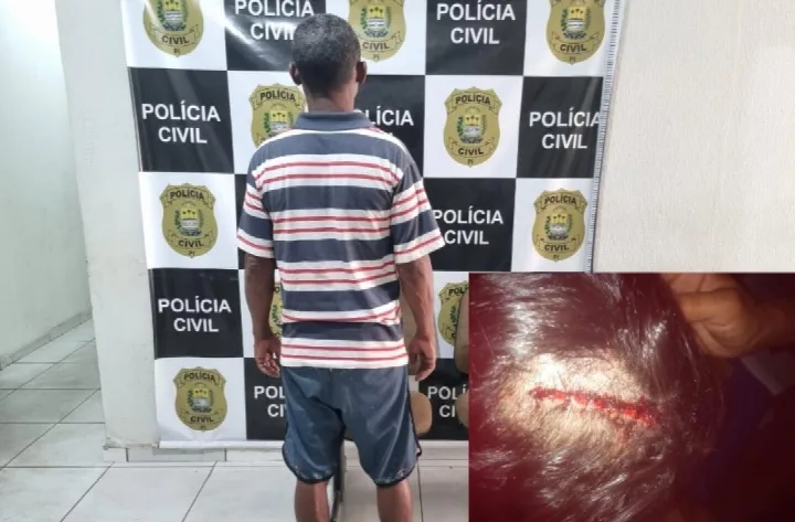Homem é preso em Oeiras acusado de agredir companheira em Santa Cruz do Piauí