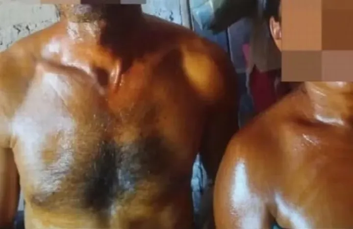 Casal sofre queimaduras após tentar apagar foco de incêndio criminoso de grandes proporções no Piauí