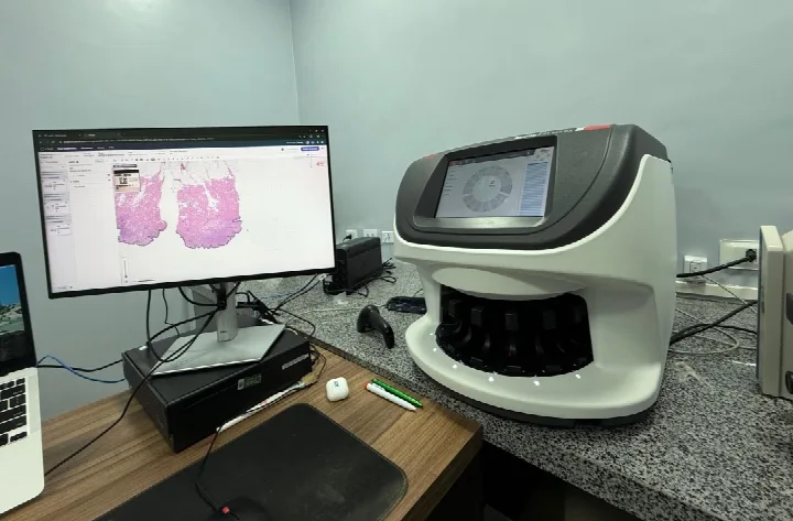 Piauí Link garante conectividade para agilizar a detecção do câncer no Hospital Getúlio Vargas (HGV)