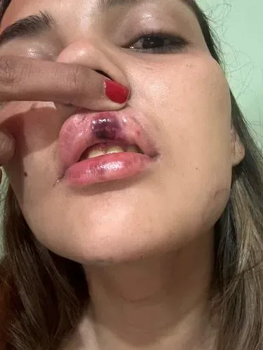Justiça decreta prisão preventiva de Valdevan Furtado, acusado de agredir a ex-namorada Danielle Barroso