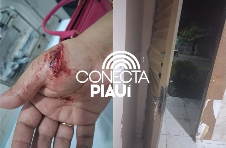 Em surto de ciúmes, homem fere a ex-mulher com facada em Monsenhor Gil