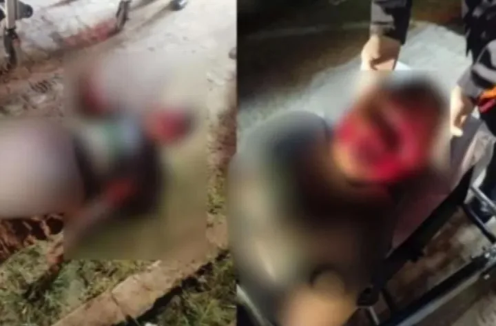 Homem é brutalmente agredido e fica com rosto desfigurado após tentativa de homicídio no Piauí
