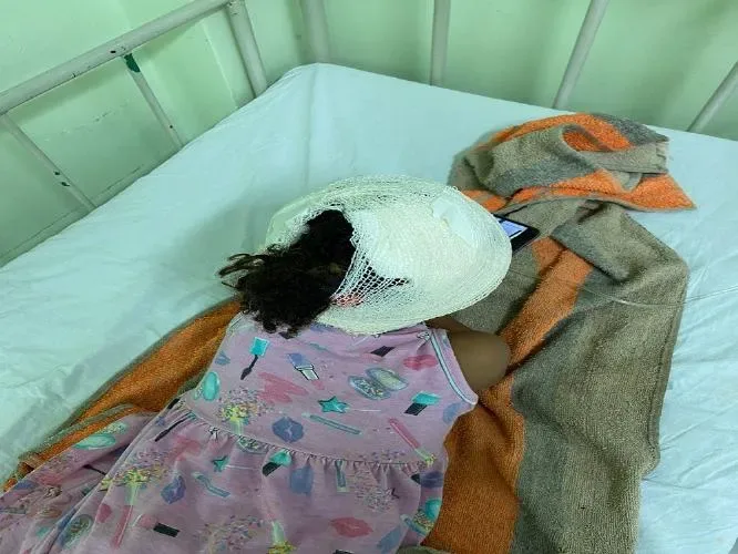 Menina de quatro anos é atacada por cão da raça pit monster em Oeiras
